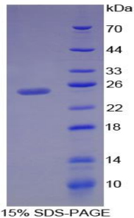 SDS-PAGE